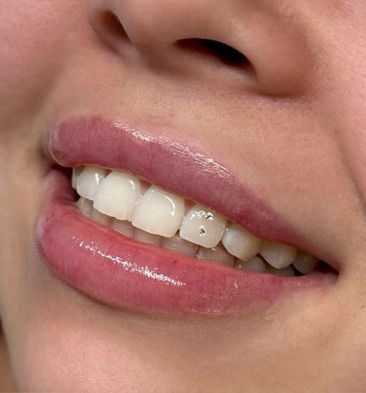 Tooth gem placement by Falastina